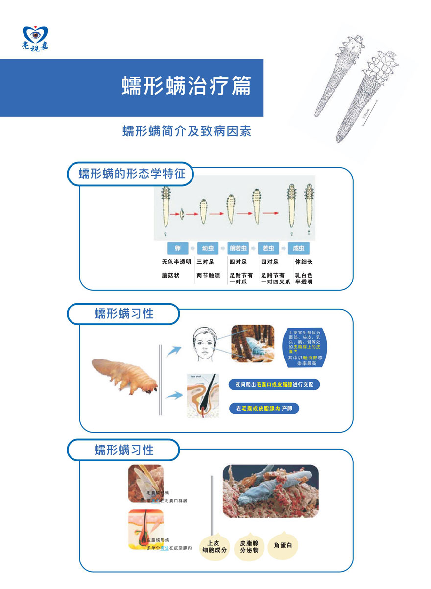 (干眼門診文宣)蠕形螨簡(jiǎn)介及治病因素